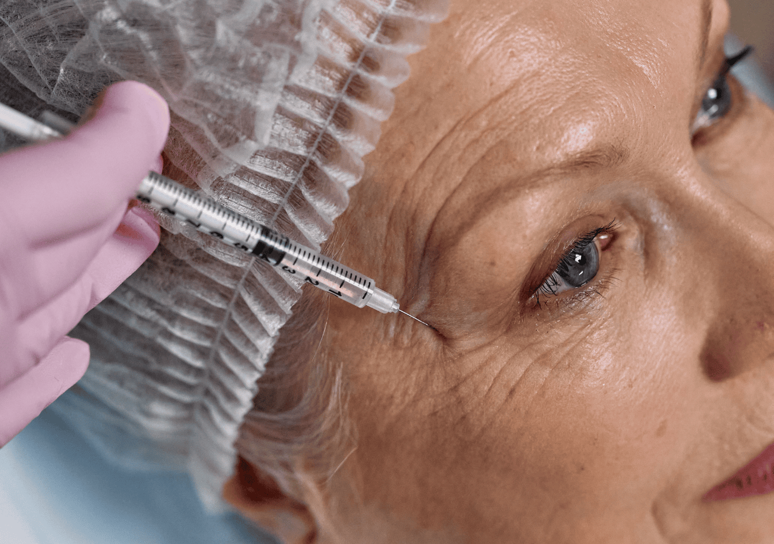 Dermal Fillers