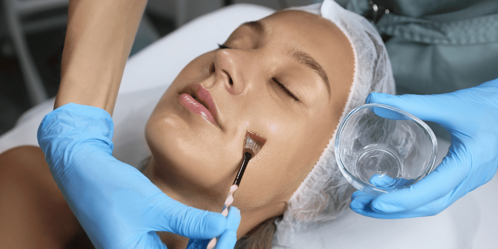 Chemical Peel (BioRePeel)