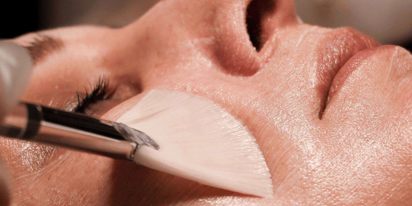 Dermatological Facial