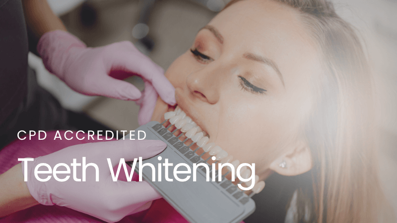 Teeth Whitening