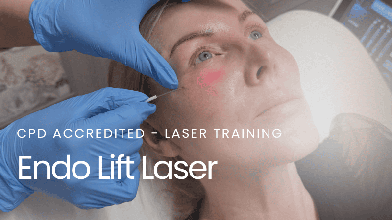 Endo Lift Laser