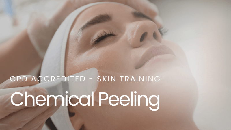 Chemical Peeling