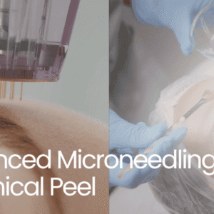 Level 5 course banner: Advanced Microneedling and Chemical Peel