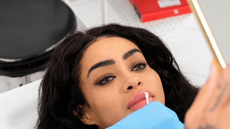 Close-up-image-of-lip-filler Close-up of a client's lips after lip filler treatment, with a mirror used to check results