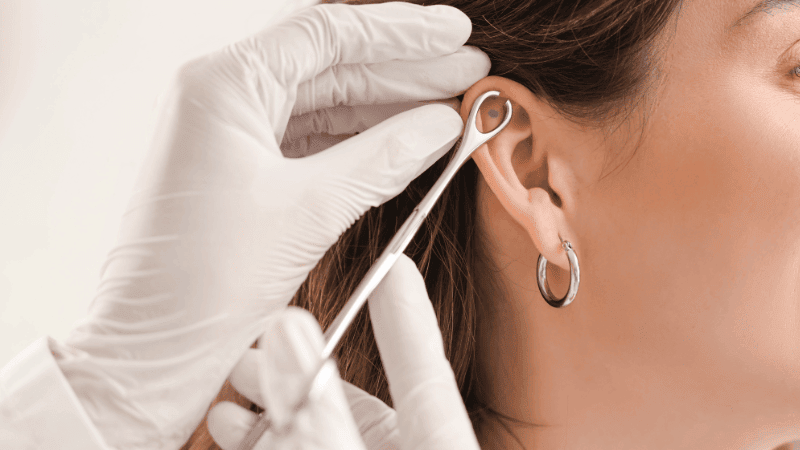 ear piercing page Close-up image of a practitioner lining up tool for ear piercing