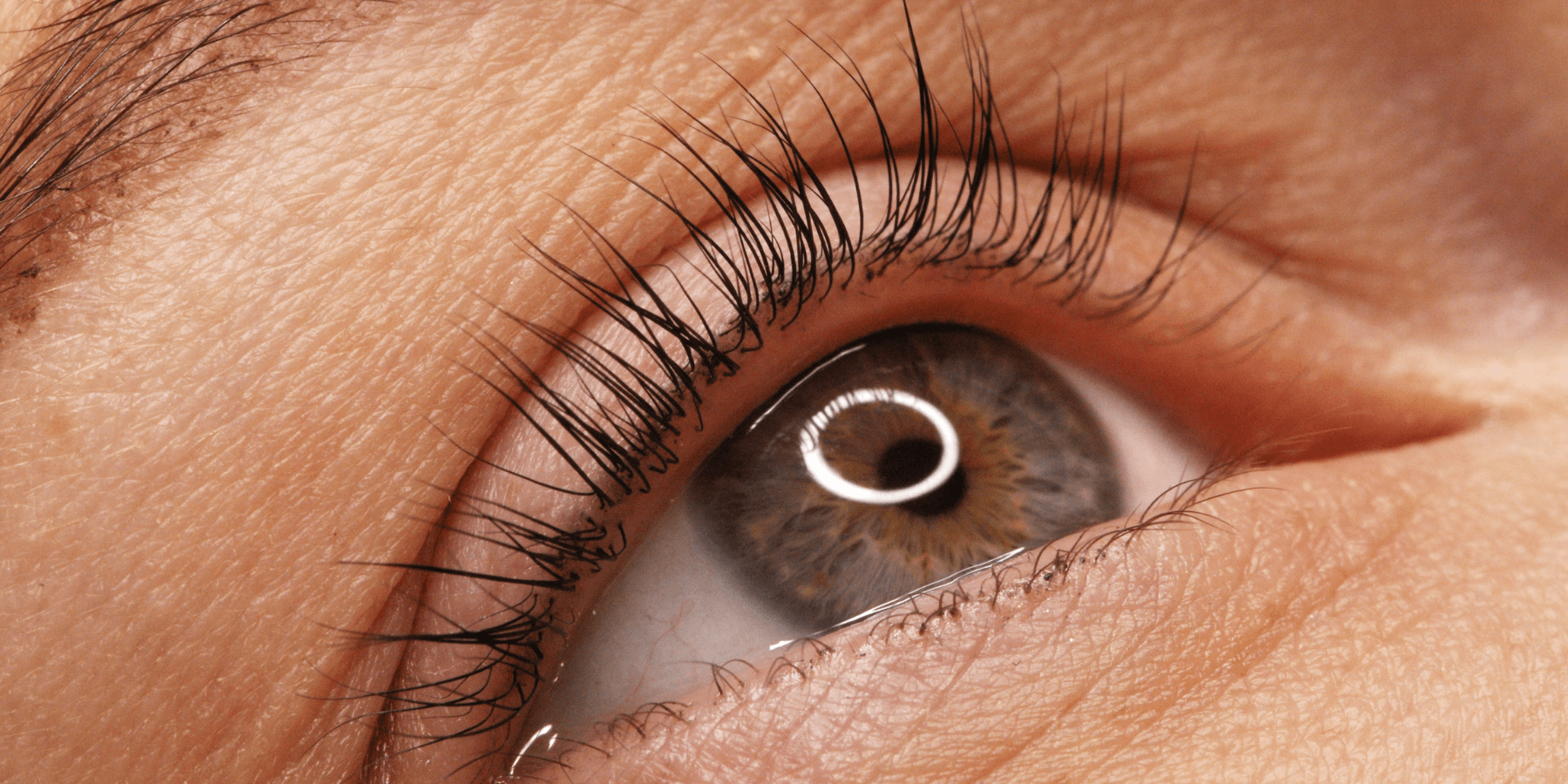 Close-up of a client's eye during an aesthetic treatment consultation