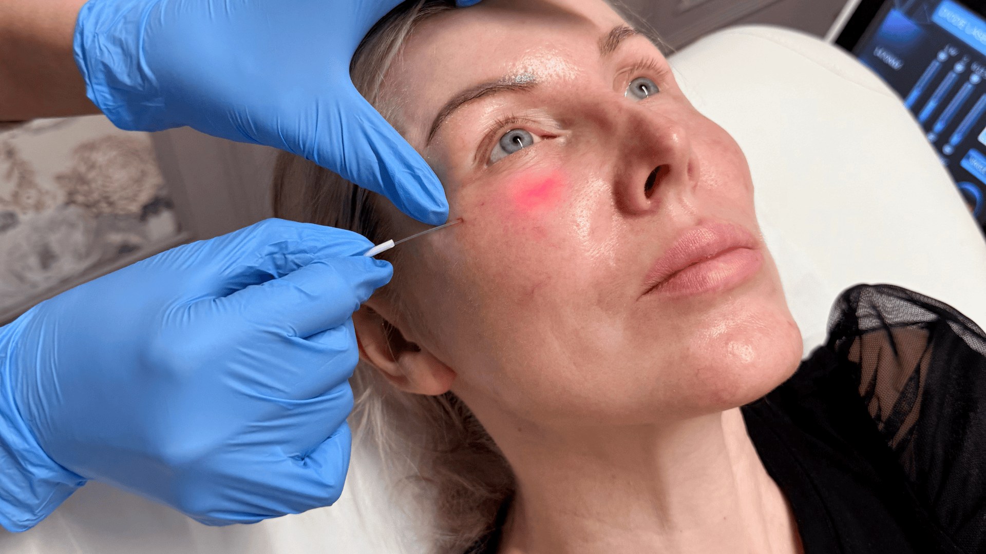 Clinician applying an injectable aesthetic treatment to a client's face