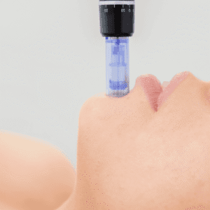 Microneedling skin rejuvenation treatment