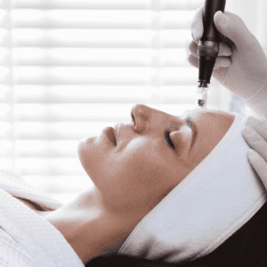 Microneedling treatment by practitioner