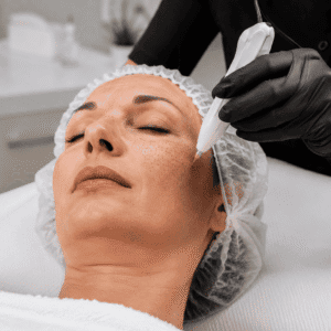 Dermaplaning treatment at Jazz Beauty Clinic