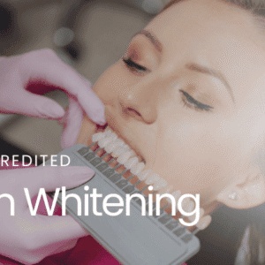 CPD Accredited: Teeth Whitening training course banner
