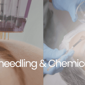 Level 4 course banner: Microneedling and Chemical Peel