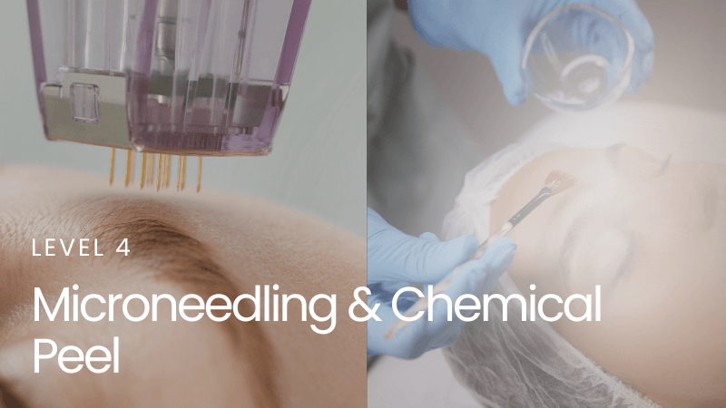 Microneedling & Chemical Peel – Level 4